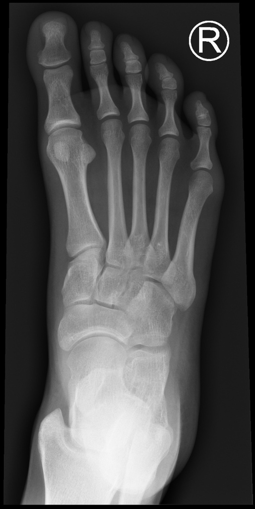 male_foot-(1).jpg