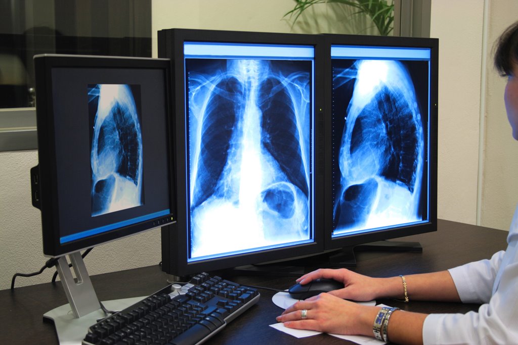 recruitment-of-radiographers-to-increase-and-more-reporting